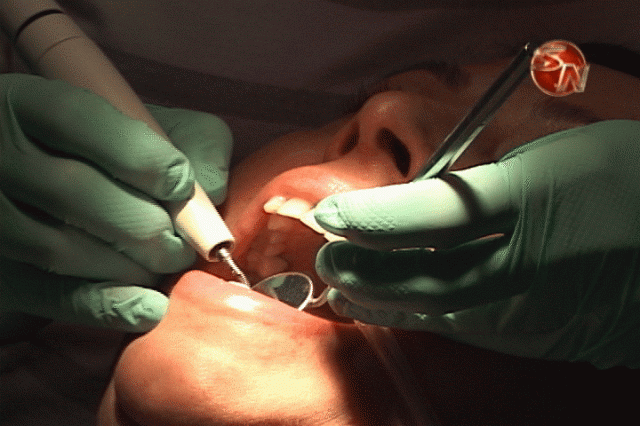 A cuidarse los dientes en este tiempo. A cuidarse los dientes en este tiempo.