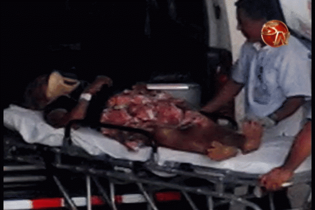 Fue trasladada al hospital. Fue trasladada al hospital.