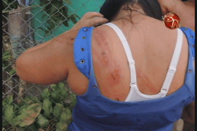 La mujer tiene varias heridas. La mujer tiene varias heridas.