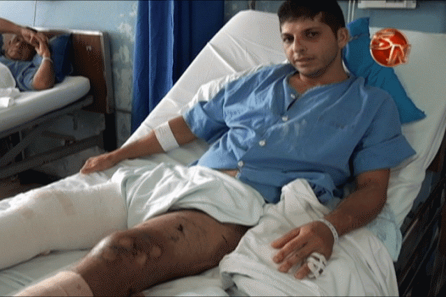 Pablo Ceciliano, tiene fracturas en sus piernas. Pablo Ceciliano, tiene fracturas en sus piernas.