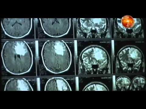 Hospital Escalante Pradilla pretende contar con equipo para operar tumores de cerebro