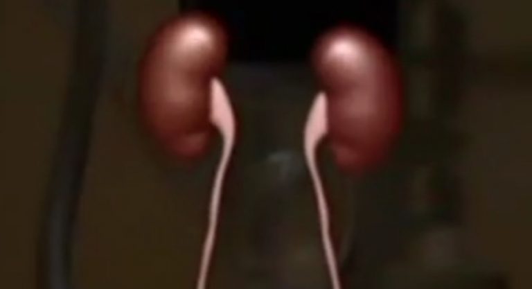Movilización une esfuerzos en Pérez Zeledón por la salud renal