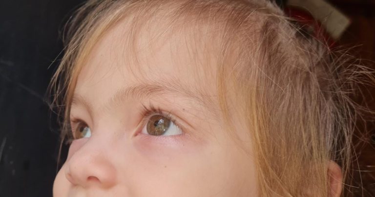 ¡No se ´´rasque´´ los ojos!
