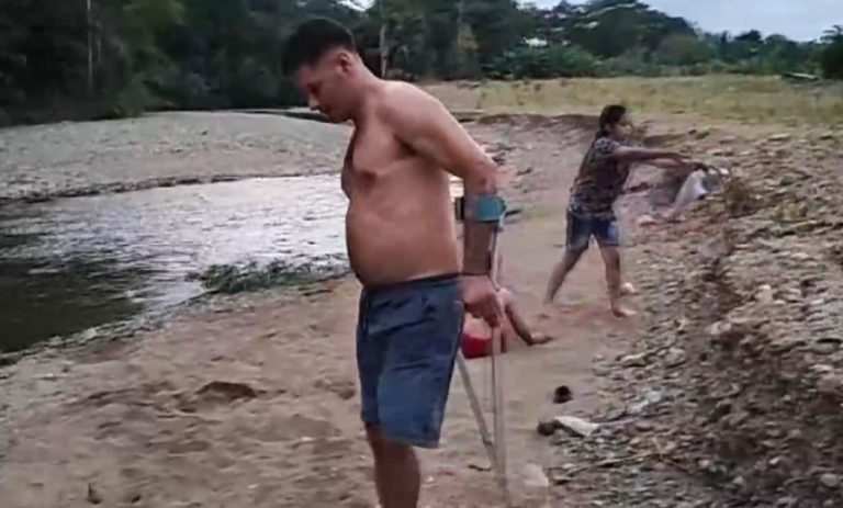 Vecino de Osa busca ayuda para tener una prótesis tras perder pierna en accidente