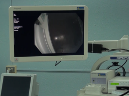 Mejoran el servicio de Gastroentereología del Hospital Escalante Pradilla con nuevo equipo valorado en 23 millones de colones